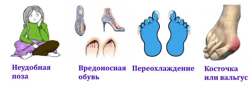 Бытовые причины онемения большого пальца ноги