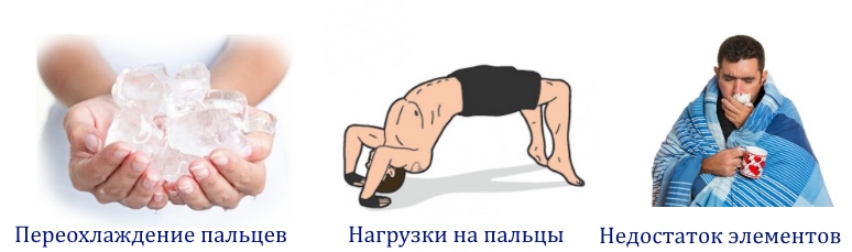 Частые причины онемения пальцев