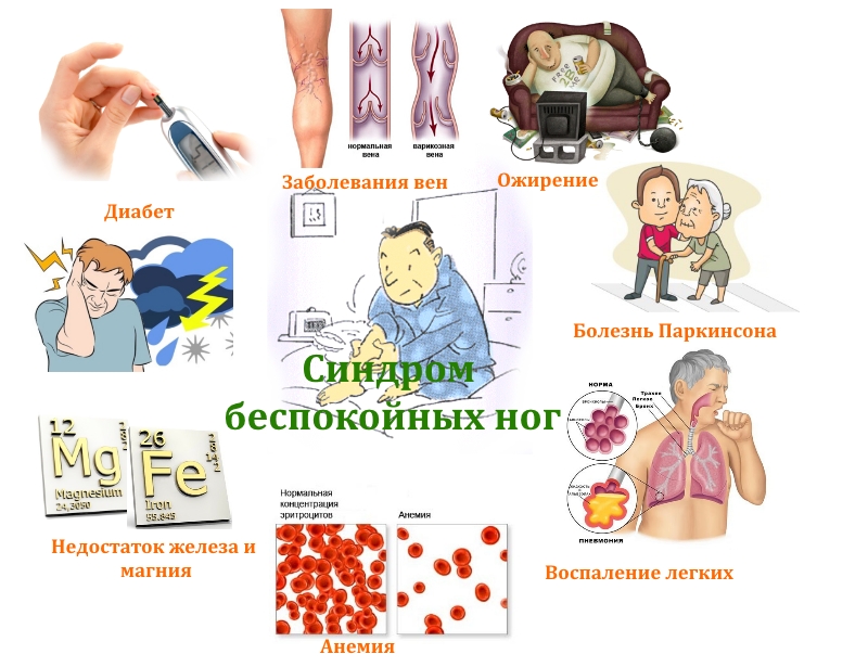 Частые причины синдрома беспокойных ног
