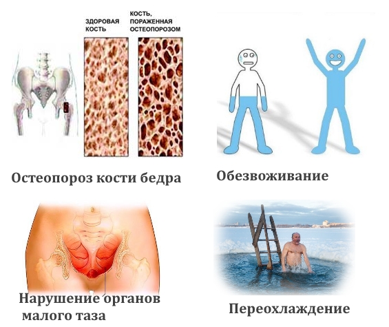 Частые причины судорог бедра