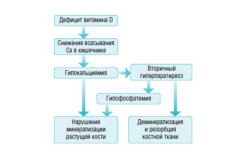 Дефицит витамина D
