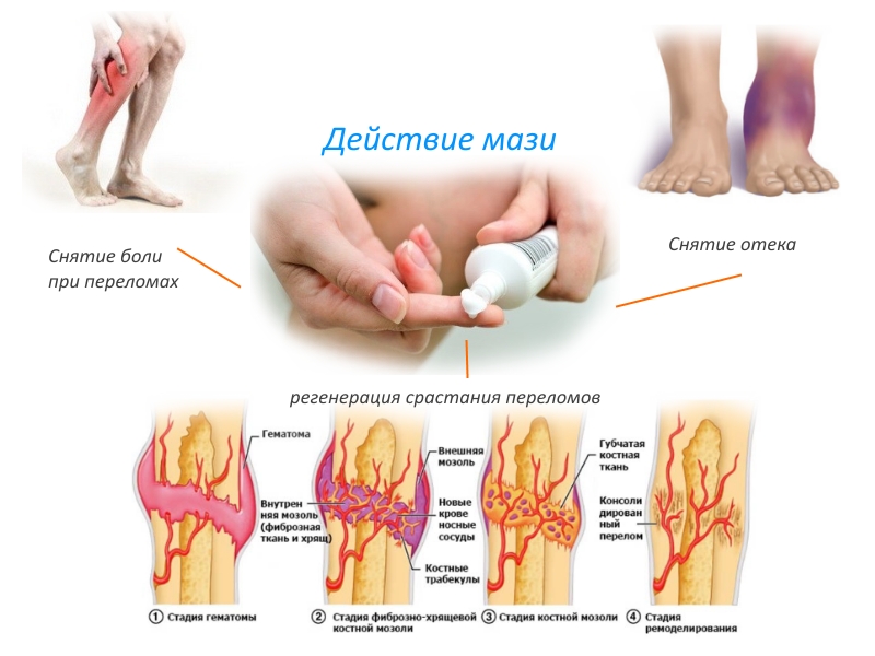 Действие мази при переломах