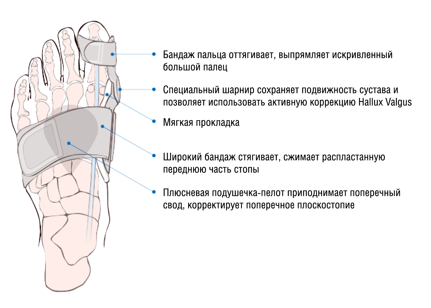Действие шины Hallufix