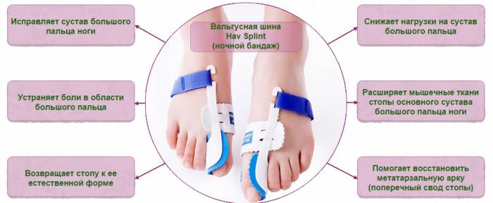 Преимущества фиксатора Hav Splint 