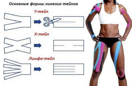 Формы тейпов на колено