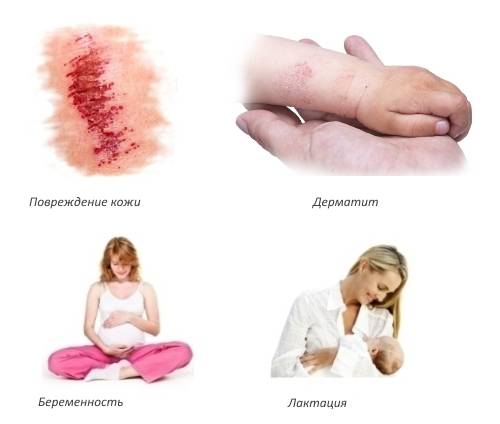 Противопоказания для Финалгона