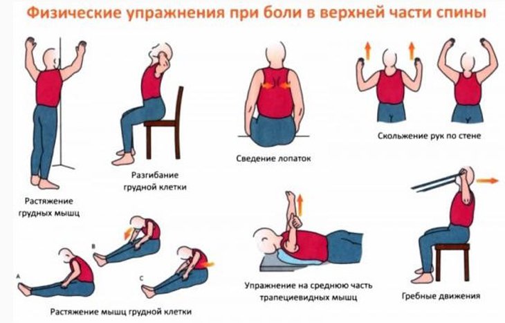 Лечебная гимнастика при боли вверху спины