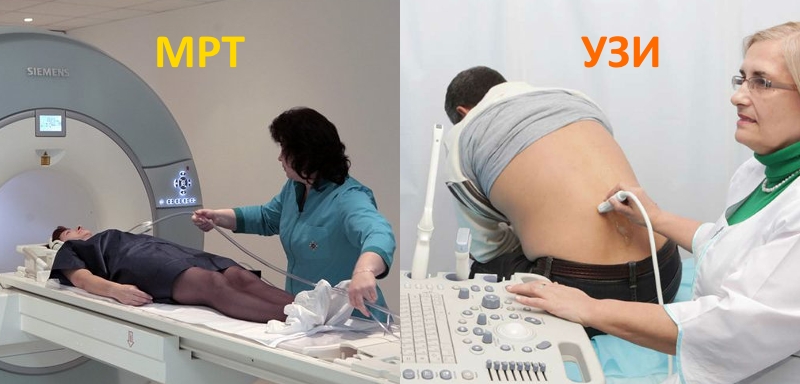 МРТ и УЗИ поясницы