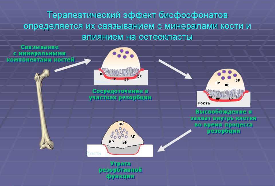 Механизм действия бисфосфонатов