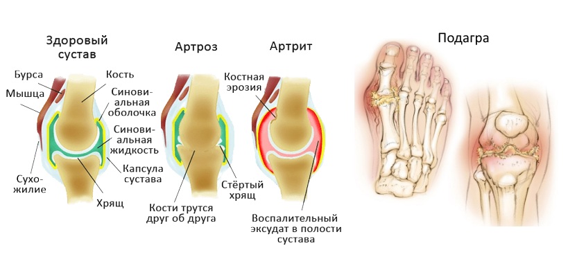 Назначение Суставикса