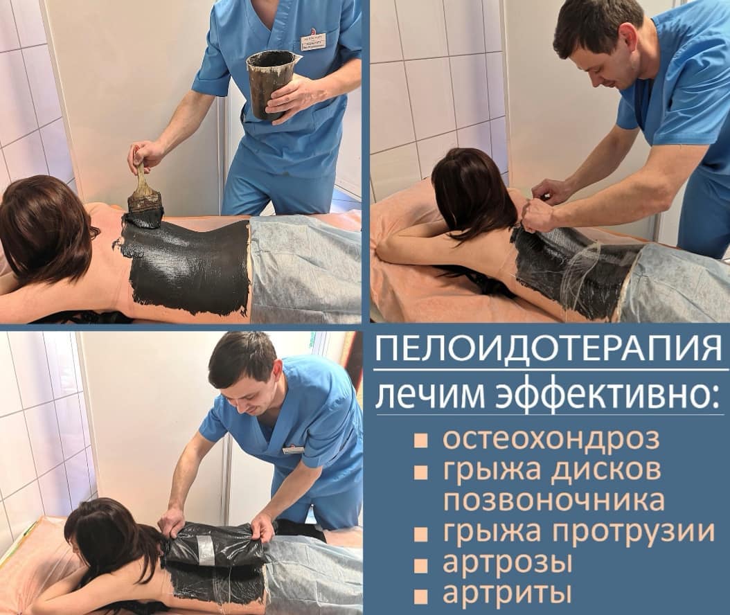 Назначение грязелечения
