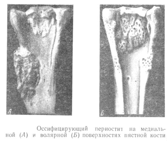 Оссифицирующий периостит