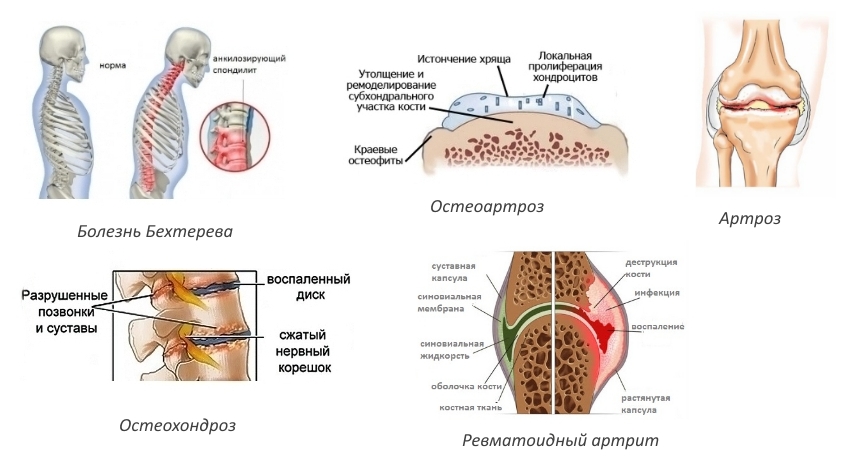 Показания для Мовалиса