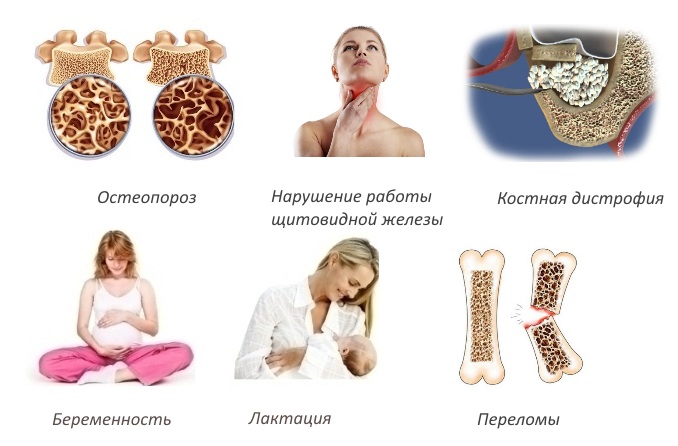 Показания для Альфадола
