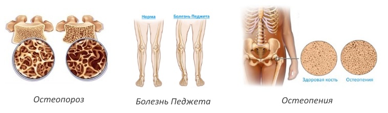 Показания для применения Алостина