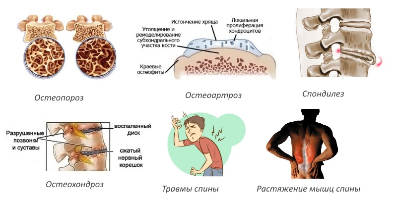 Показания для Артрина