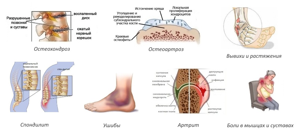 Показания для Артротека