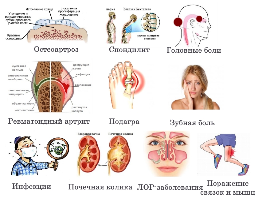 Показания для Фанигана