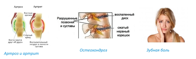 Показания для Кетодексала