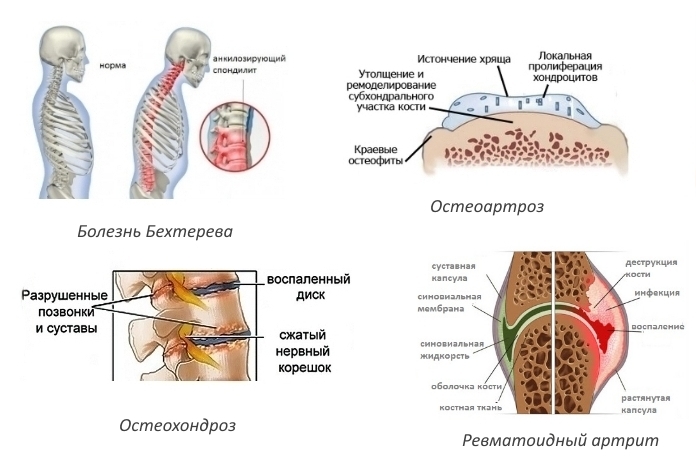 Показания для Амелотекса