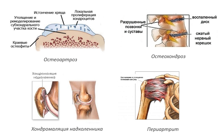 Показания для Протекона