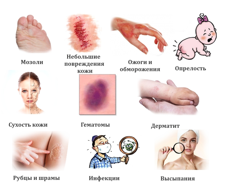 Показания для бальзама Спасатель