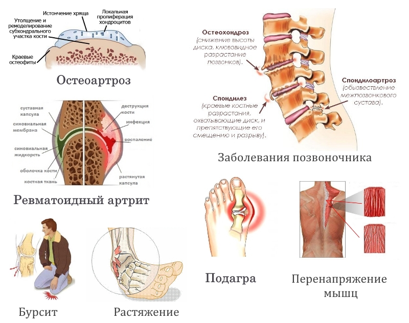 Показания для геля Фаниган