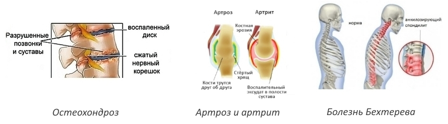 Показания для приема Мовасина