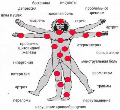 Показания к применению магнитотерапии
