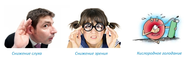 Последствия кифоза шеи