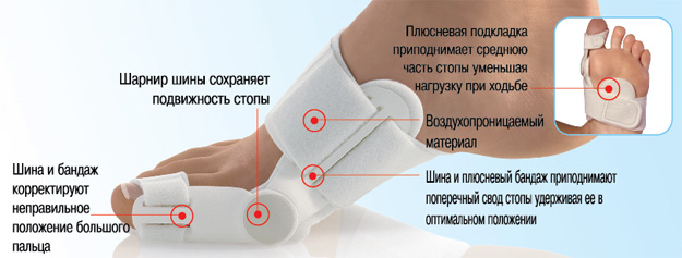 Преимущества шины Валюфикс