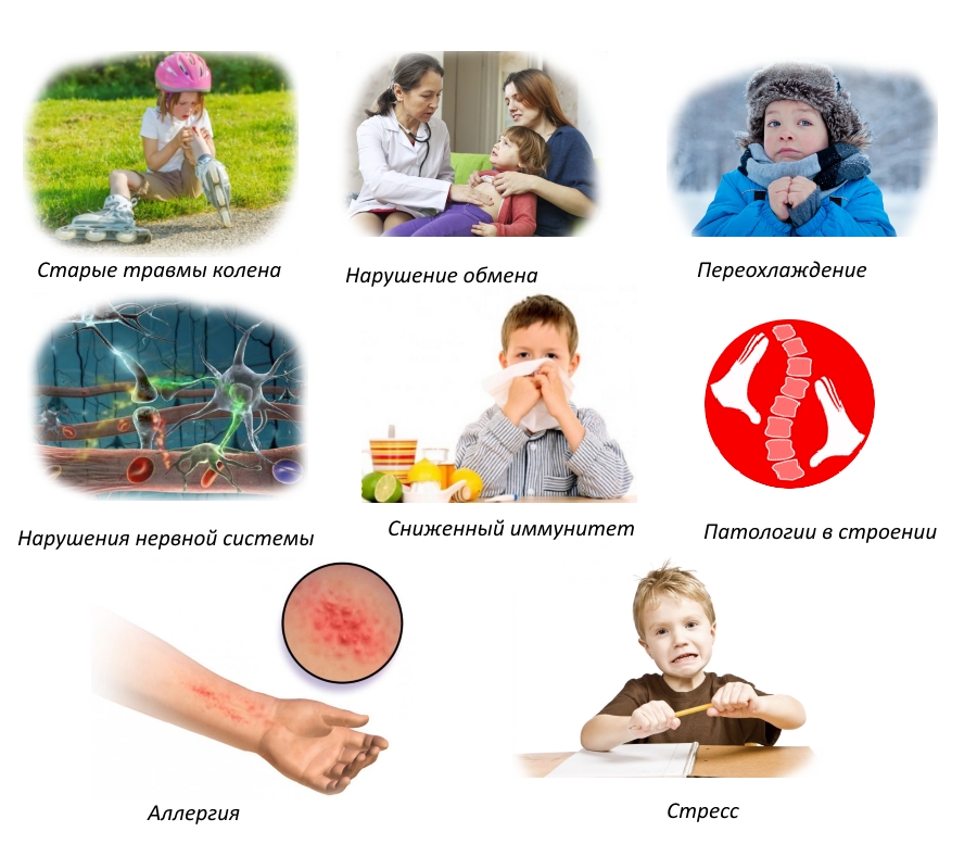 Причины артрита у детей
