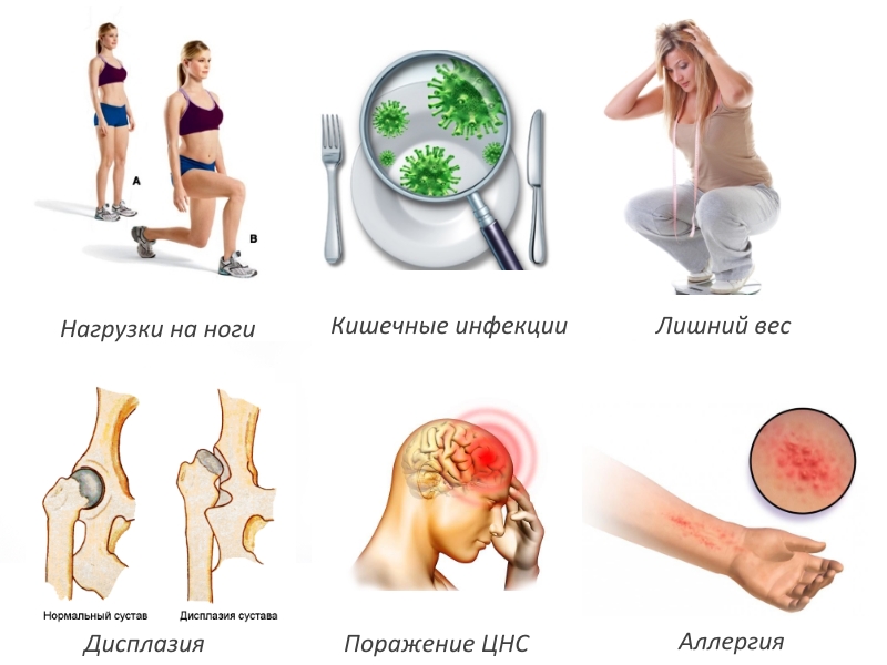 Частые причины артрита