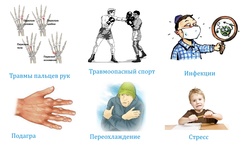 Причины артроза пальцев рук