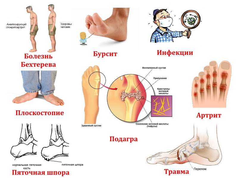 Причины боли в стопе