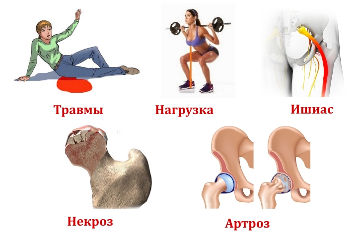 Причины боли в тазу и ноге
