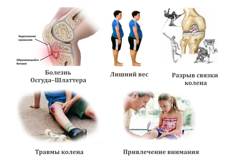 Частые причины боли в колене у ребенка