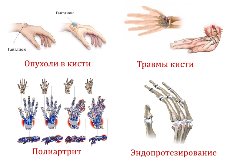 Показания для диагностики