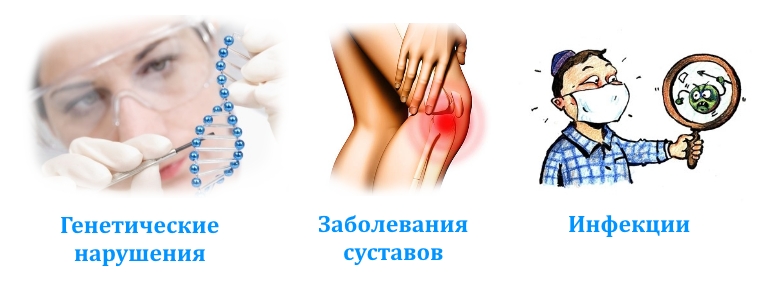 Причины фиброзной дисплазии