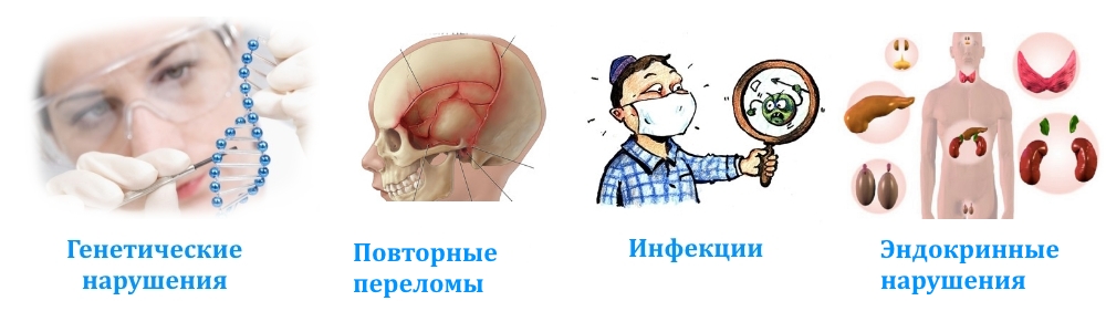 Причины фиброзной дисплазии