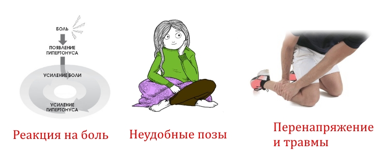 Причины гипертонуса мышц