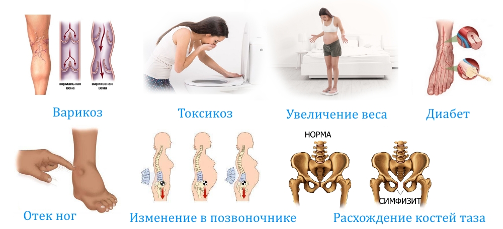 Причины онемения ног при беременности
