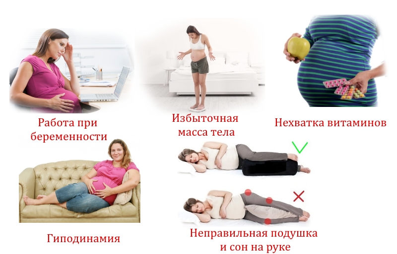 Причины онемения рук при беременности