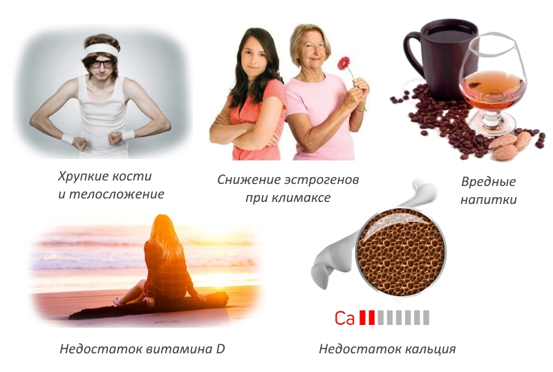 Причины остеопороза