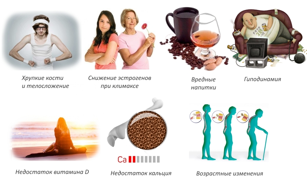 Частые причины остеопороза