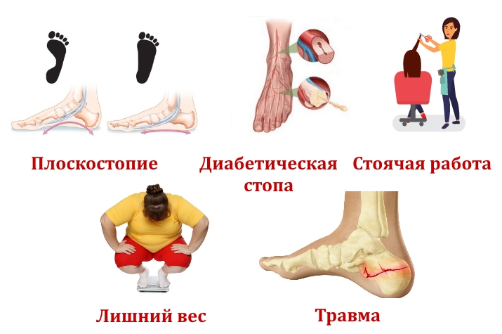 Причины пяточной кисты