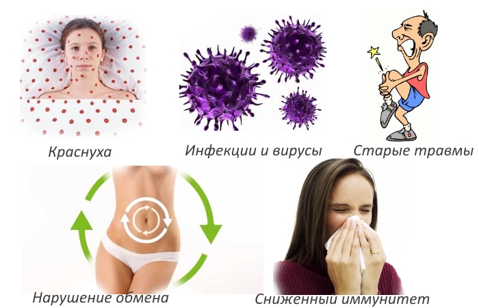 Причины полиартрита
