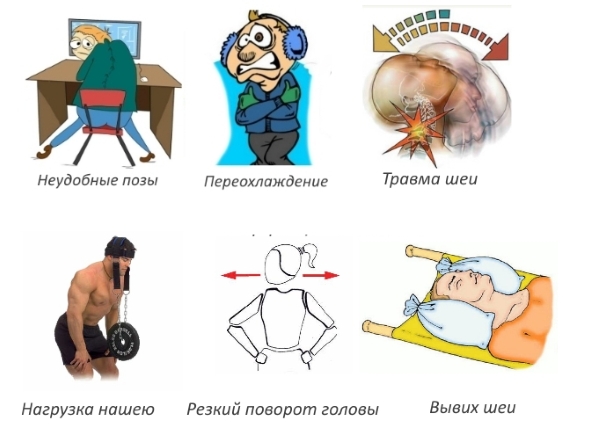 Причины растяжения шеи