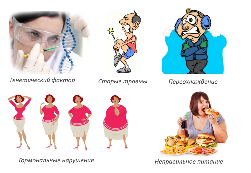 Частые причины артрита