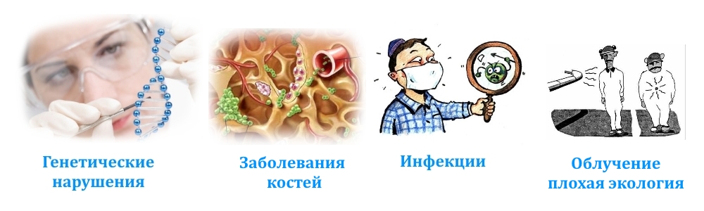Причины саркомы бедра